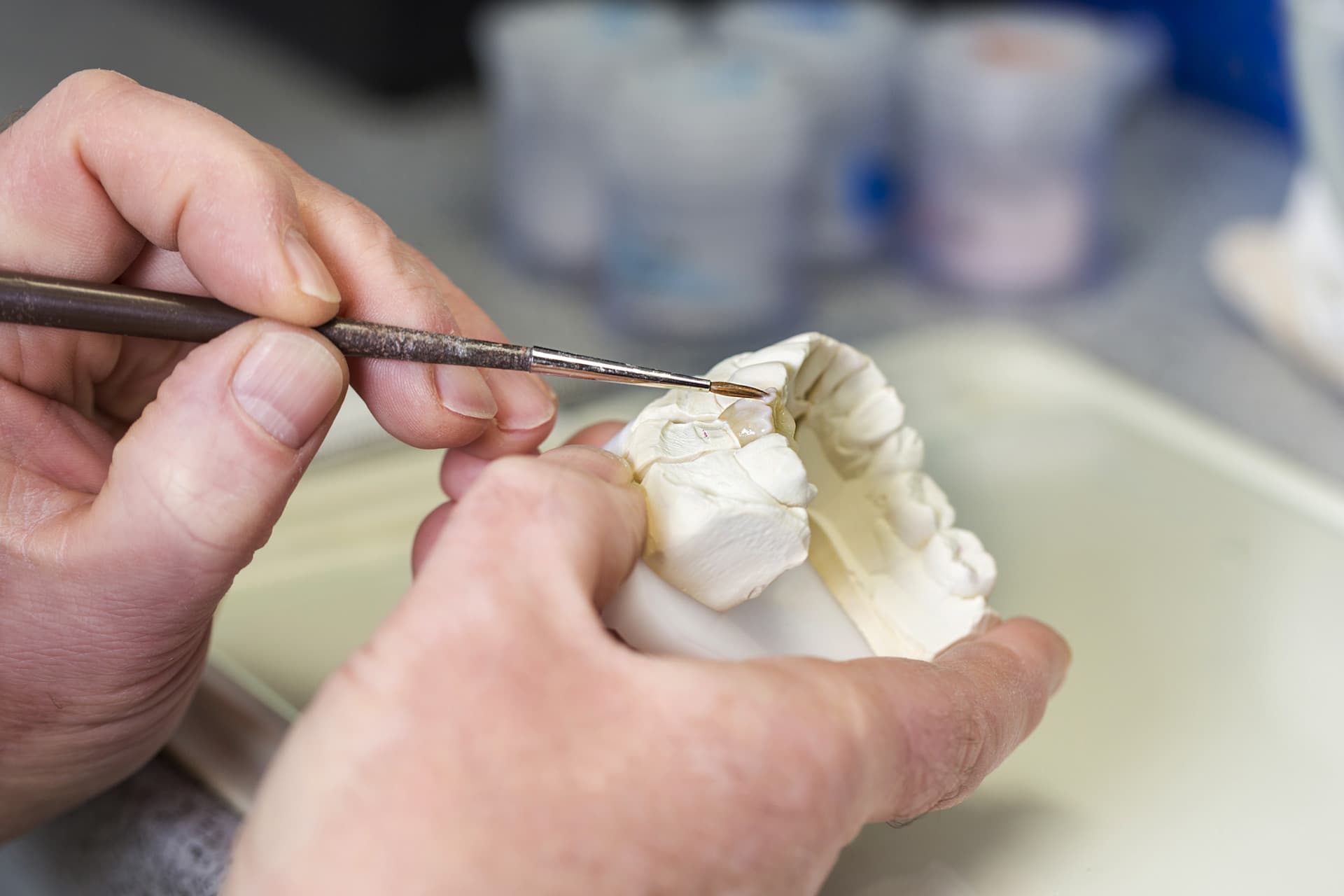 Laboratorio dental - Prótesis dentales en Cambados